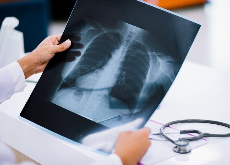 Interventional Radiology Services